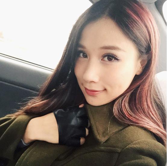 看得出小变化吗?双眼皮矫正+缩鼻翼