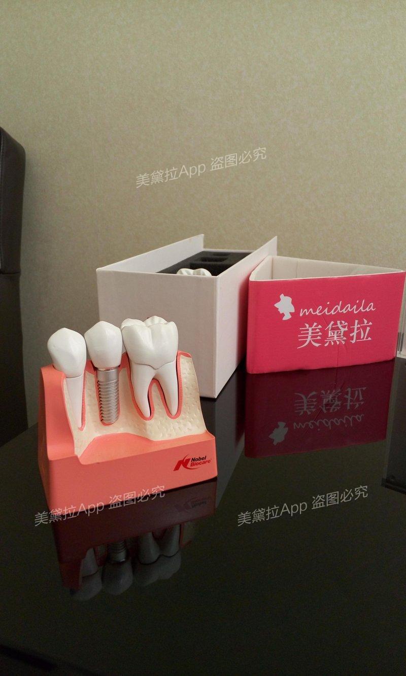 洗牙如洗澡,不能美白牙齿也不会松牙